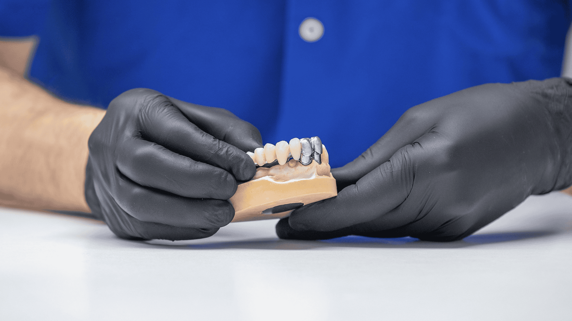 Lippert Dentaltechnik Zahnersatz den man nicht sieht